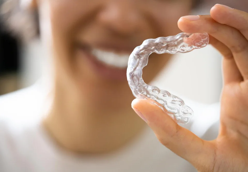 Aligners Over Traditional Braces