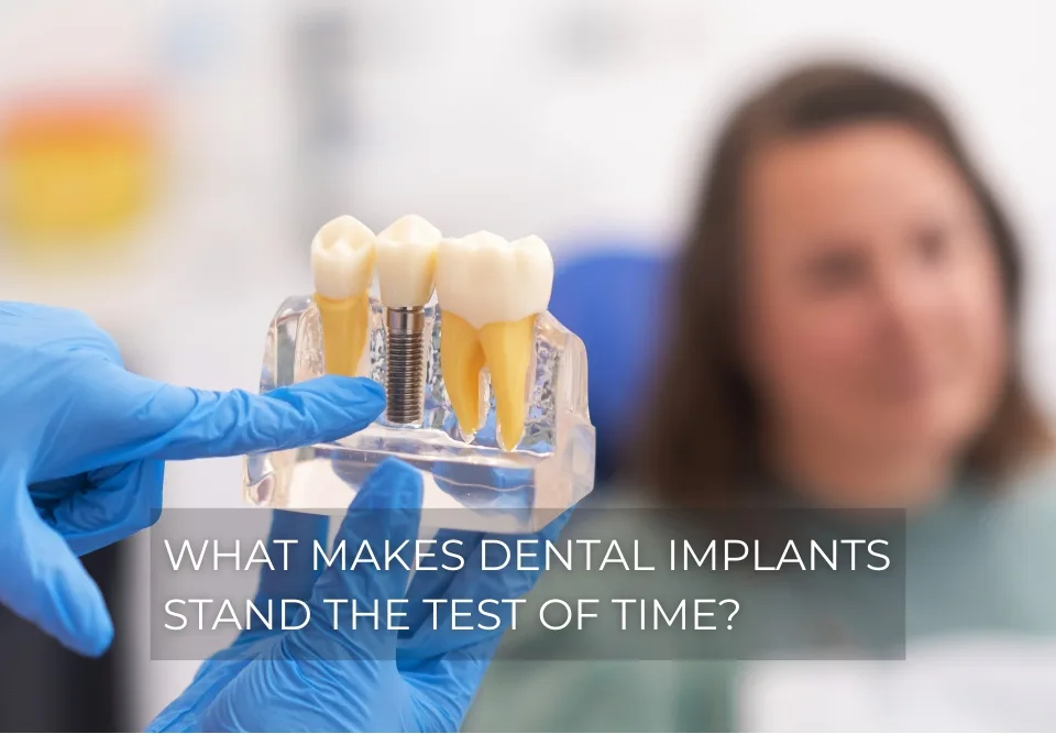 What Makes Dental Implants Stand the Test of Time
